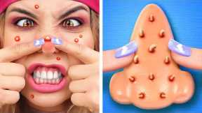 Don’t touch the PIMPLES *Amazing TOYS and GADGETS from Tik Tok*