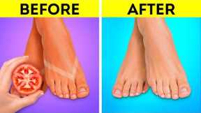 Foot Care Hacks 🦶👣 Smart Hacks To Keep Your Feet Nice And Smooth
