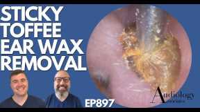 STICKY TOFFEE EAR WAX REMOVAL - EP897